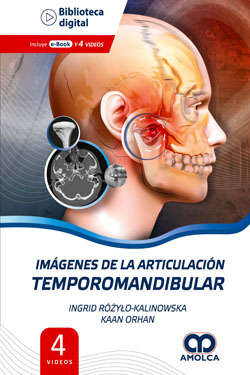 Imágenes de la Articulación Temporomandibular