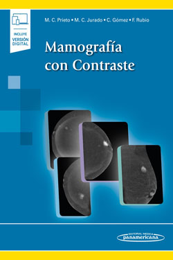 Mamografía con Contraste + Ebook