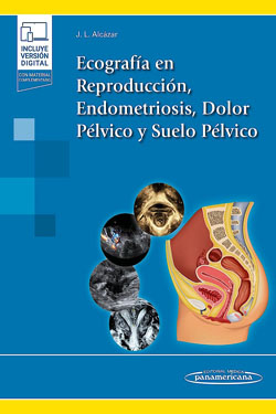 Ecograf�a en Reproducci�n, Endometriosis, Dolor P�lvico y Suelo P�lvico