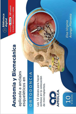Anatomía y Biomecánica Aplicada a Anclajes Esqueléticos en Ortodoncia