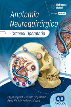 Anatomía Neuroquirúrgica
