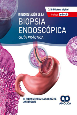 Interpretación de la Biopsia Endoscópica