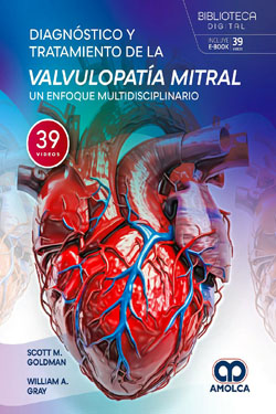 Diagnóstico y Tratamiento de la Valvulopatía Mitral