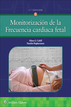Monitorización de la Frecuencia Cardiaca Fetal
