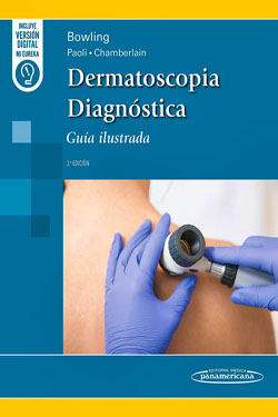Dermatoscopia Diagnstica