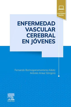 Enfermedad Vascular Cerebral en Jo?venes