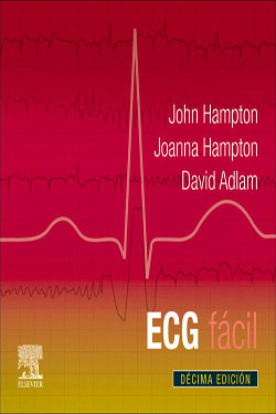 ECG Fa?cil