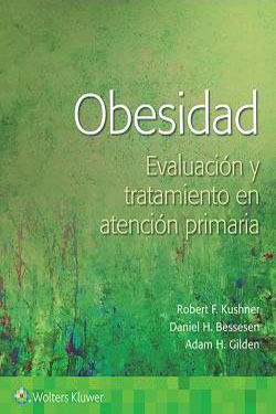 Obesidad