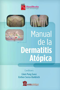 Manual de la Dermatitis Atópica