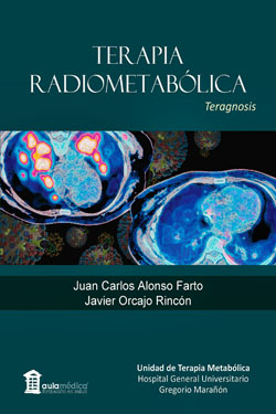 Terapia Radiometabólica Teragnosis