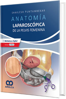 Anatomía Laparoscópica de la Pelvis Femenina