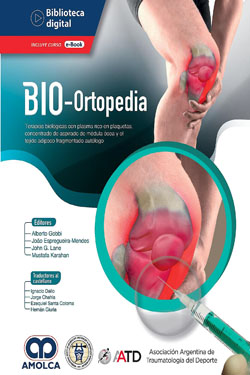 Bio-Ortopedia Terapias Biológicas con Plasma Rico en Plaquetas