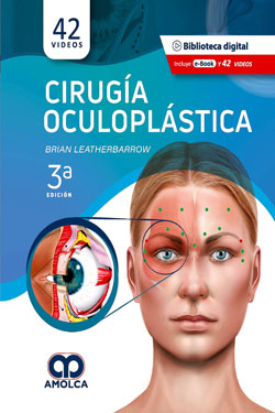 Cirugía Oculoplástica