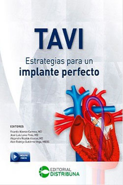 TAVI Estrategias para un Implante Perfecto