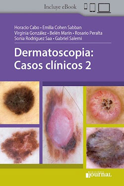 Dermatoscopia: Casos Clínicos 2