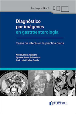 Diagnóstico por Imágenes en Gastroenterología