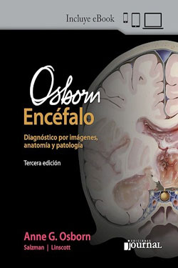 Osborn Encéfalo